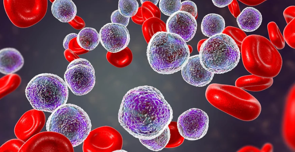 The Silent Killer of Modern Times - Understanding Myelodysplastic Syndromes (MDS)